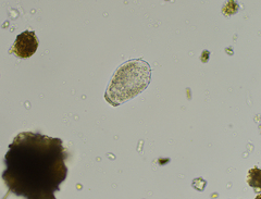 Euglyphidae