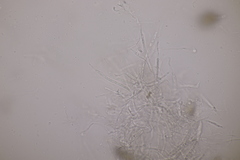 Entyloma ranunculi-scelerati