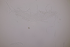 Entyloma ranunculi-scelerati