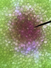 Norvellina chenopodii