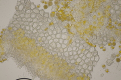 Puccinia urticata