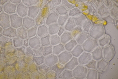 Puccinia urticata