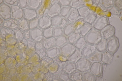 Puccinia urticata