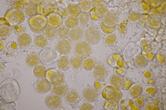 Puccinia urticata