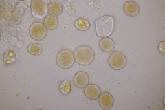 Puccinia urticata