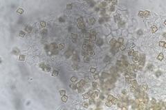 Entoloma gasteromycetoides