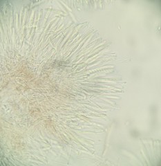 Ciboria rufofusca