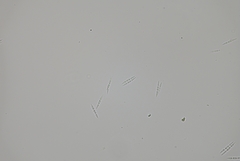 Isthmolongispora