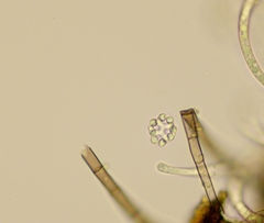 Hyaloscypha spinulosa