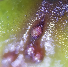 Pellia neesiana