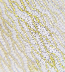 Sphagnum denticulatum