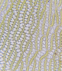 Sphagnum denticulatum