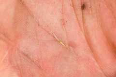 Rigiopappus leptocladus