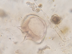 Protoperidinium