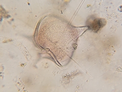 Protoperidinium