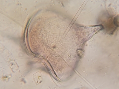 Protoperidinium