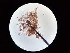 Collaria arcyrionema