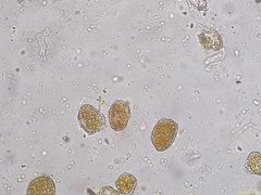 Coleosporium senecionis