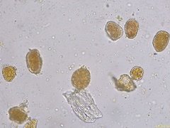 Coleosporium senecionis