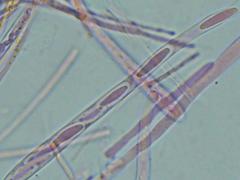 Mitrula lunulatospora