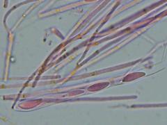 Mitrula lunulatospora