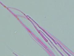 Mitrula lunulatospora