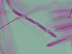 Mitrula lunulatospora