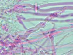 Mitrula lunulatospora