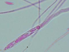 Mitrula lunulatospora