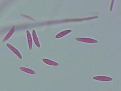 Mitrula lunulatospora