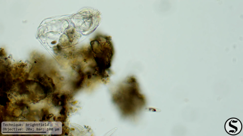 Cephalodella gibba