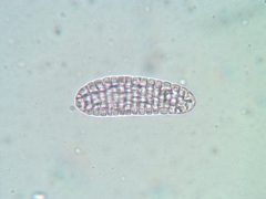 Tapellaria epiphylla