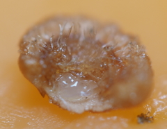 Neuroterus umbilicatus