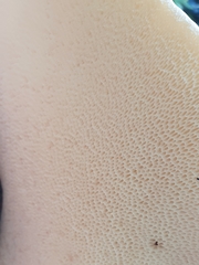 Cerioporus squamosus