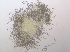 Dolichospermum
