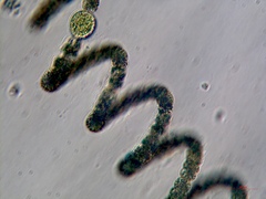 Dolichospermum