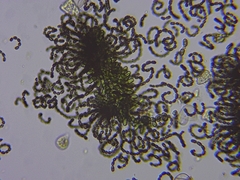 Dolichospermum lemmermannii