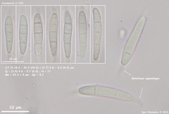 Arachnopeziza aurelia