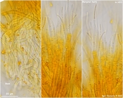 Arachnopeziza aurelia