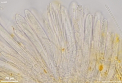 Arachnopeziza aurelia