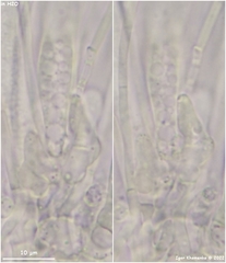 Arachnopeziza aurelia