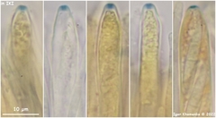 Arachnopeziza aurelia