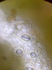 Gymnosporangium clavariiforme