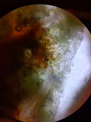 Gymnosporangium clavariiforme