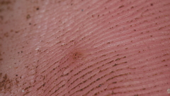 Firstpapillomavirinae