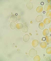 Phragmidium rosae-multiflorae