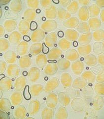 Phragmidium rosae-multiflorae