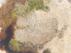 Placidiopsis minor