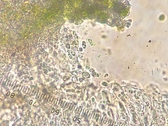 Placidiopsis minor