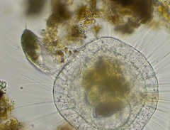 Actinosphaerium eichhornii